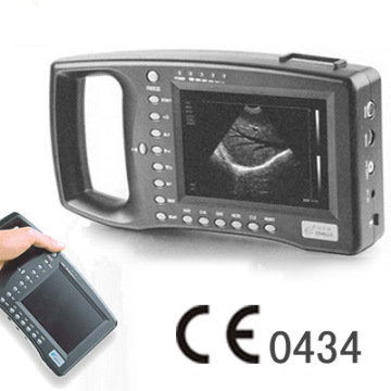 Palm Handle Vet Ultrasound Scanner (THR-2000A-Vet)